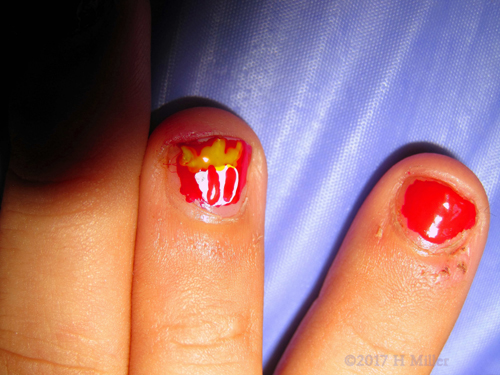 French Fries Kids Nail Art French Fries Kids Nail Art