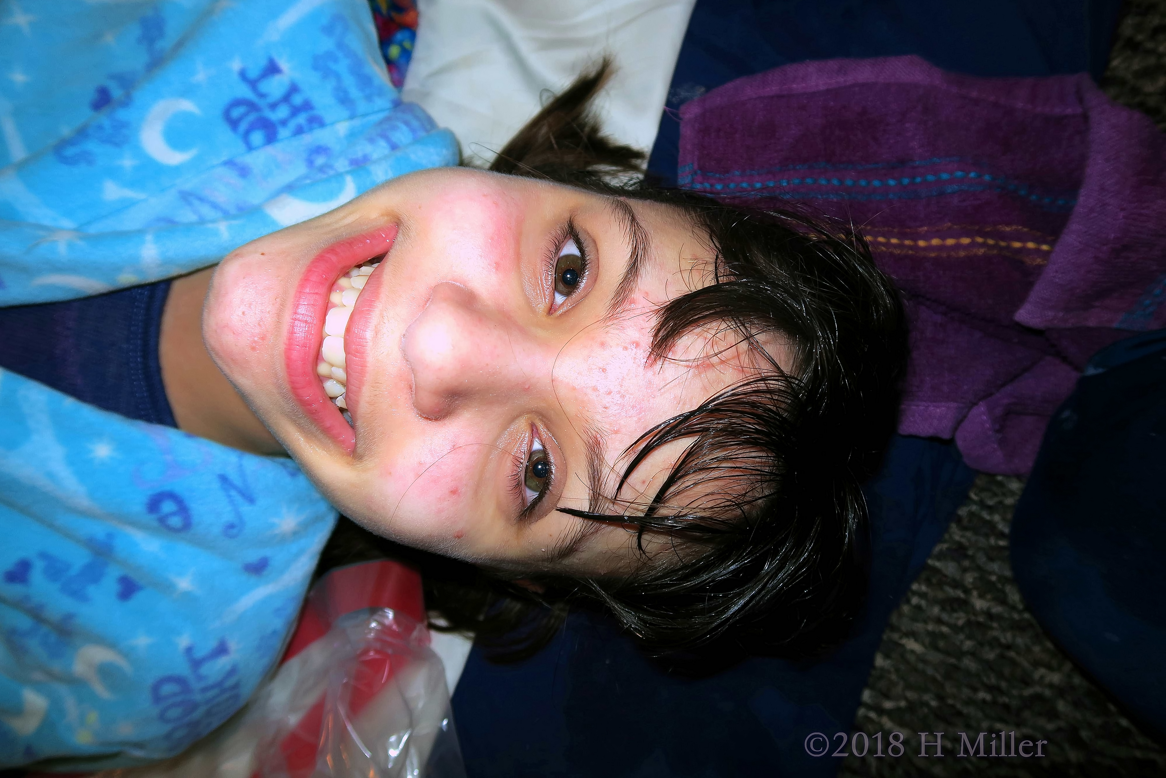 Her Skin Radiates After Perfect Kids Facial! Her Skin Radiates After Perfect Kids Facial!