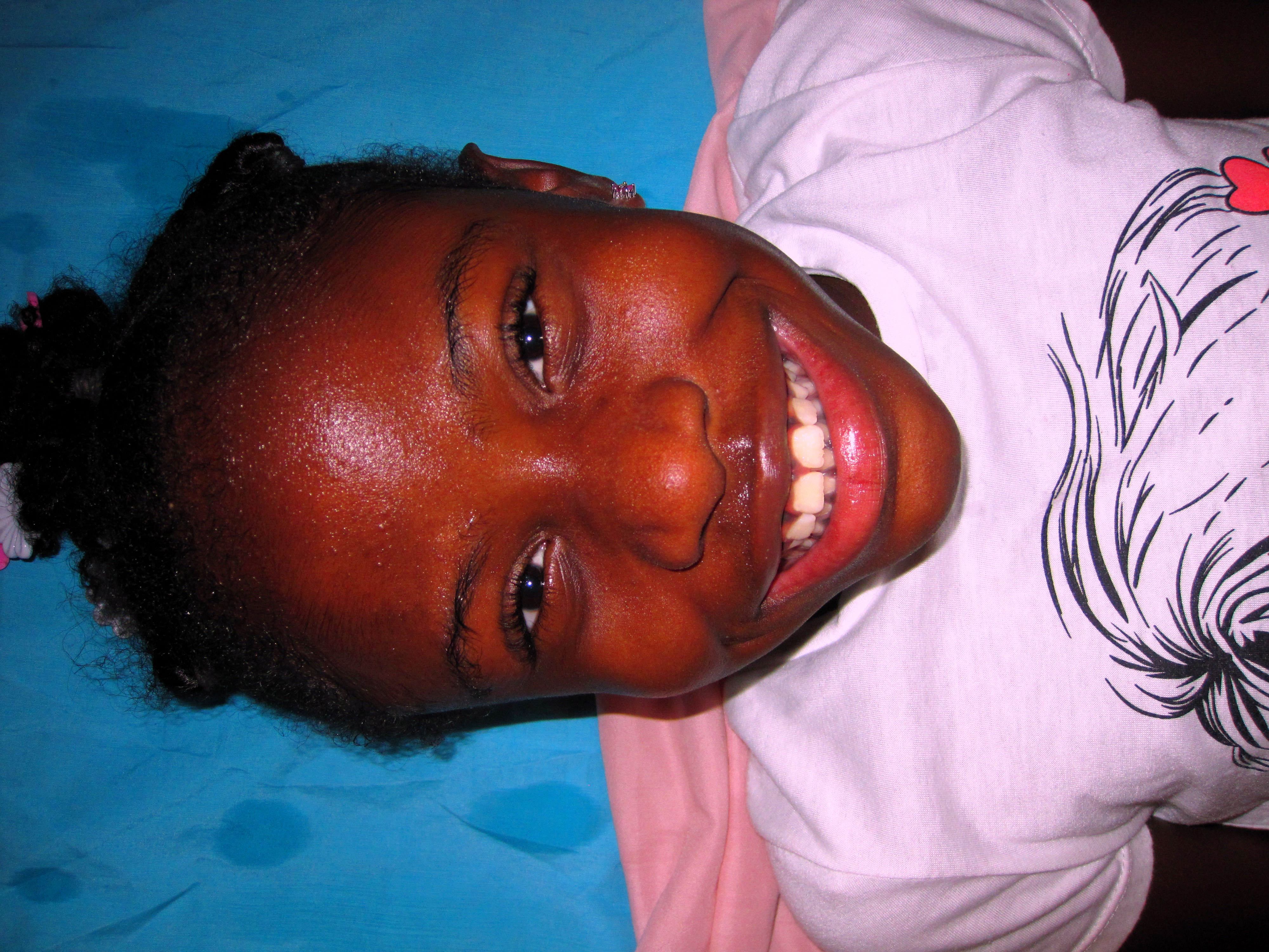 Big Smile Before Kids Facials! Big Smile Before Kids Facials!