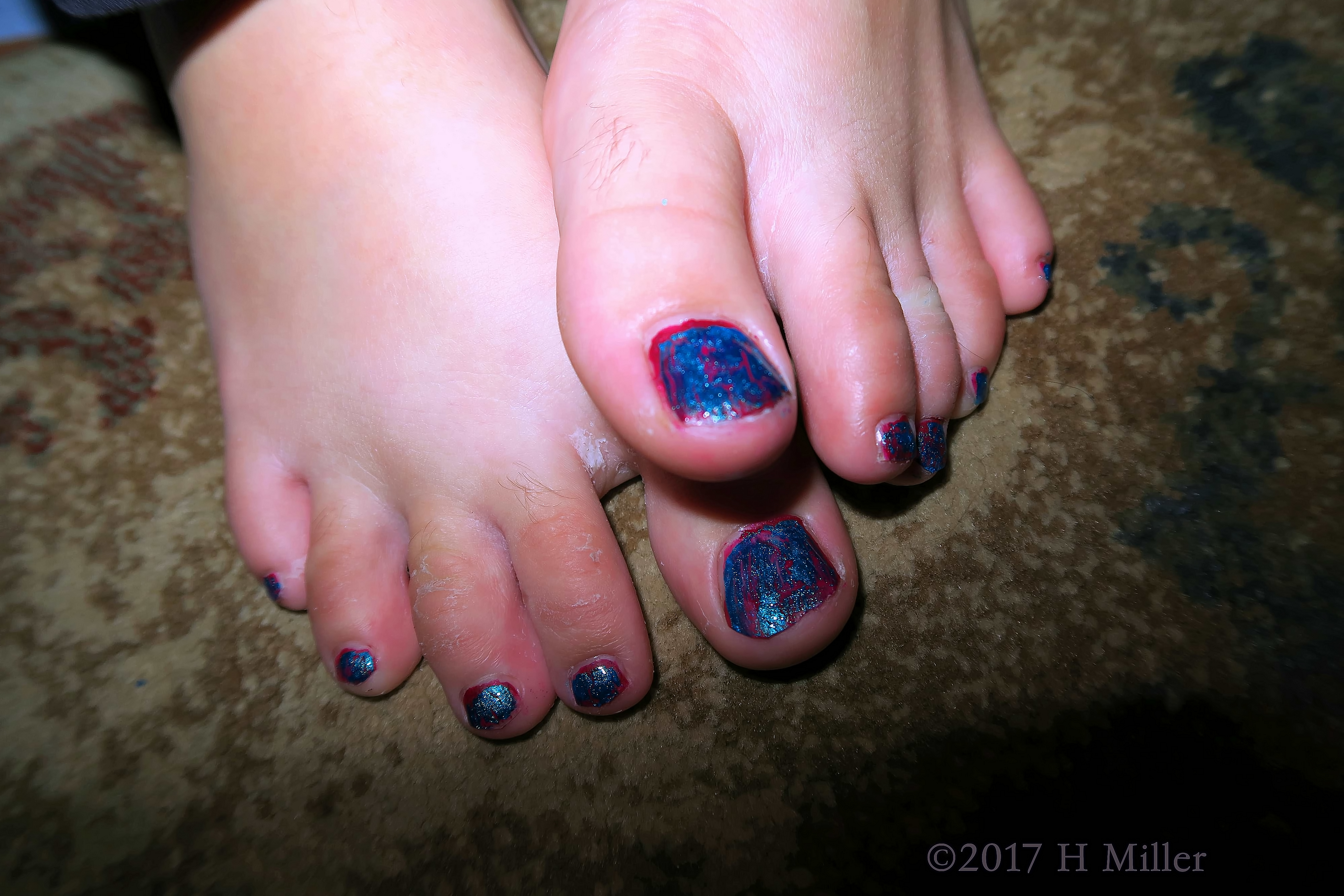 Beautiful Blue Shatter Kids Pedicure With A Pink Undertone. Beautiful Blue Shatter Kids Pedicure With A Pink Undertone.