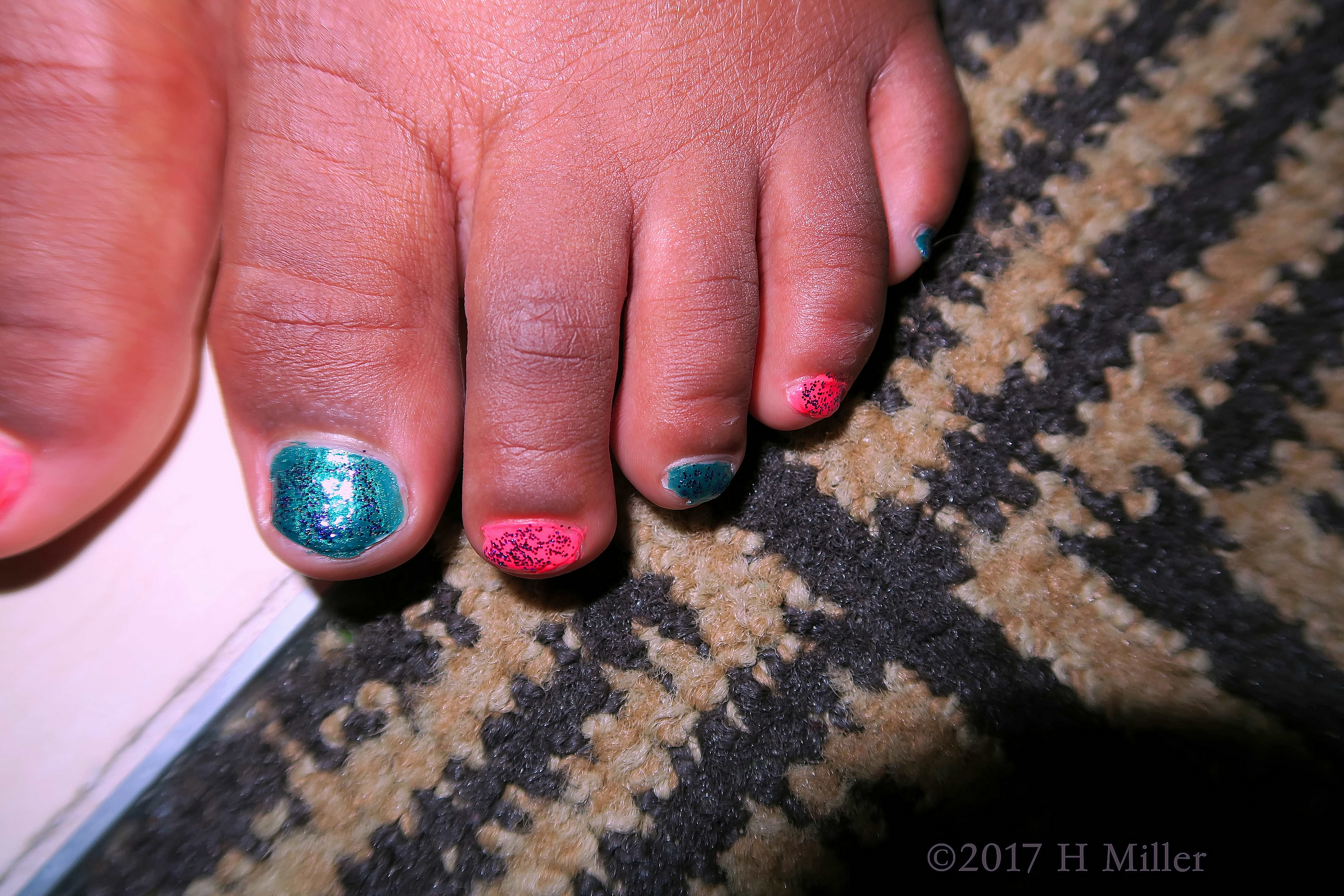 Another View Of The Alternating Color Kids Pedicure. 