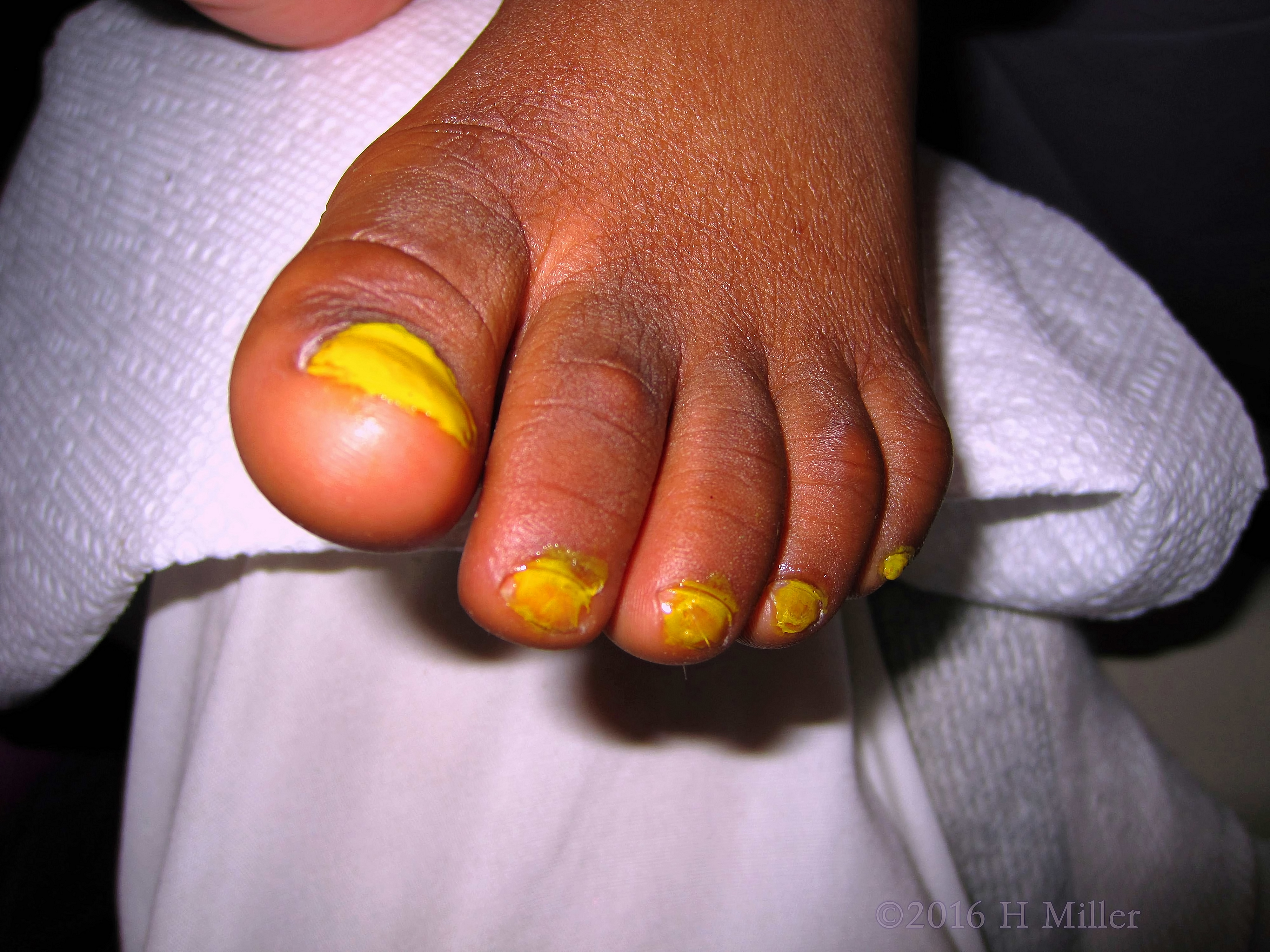 Bright Yellow Kids Pedicure 