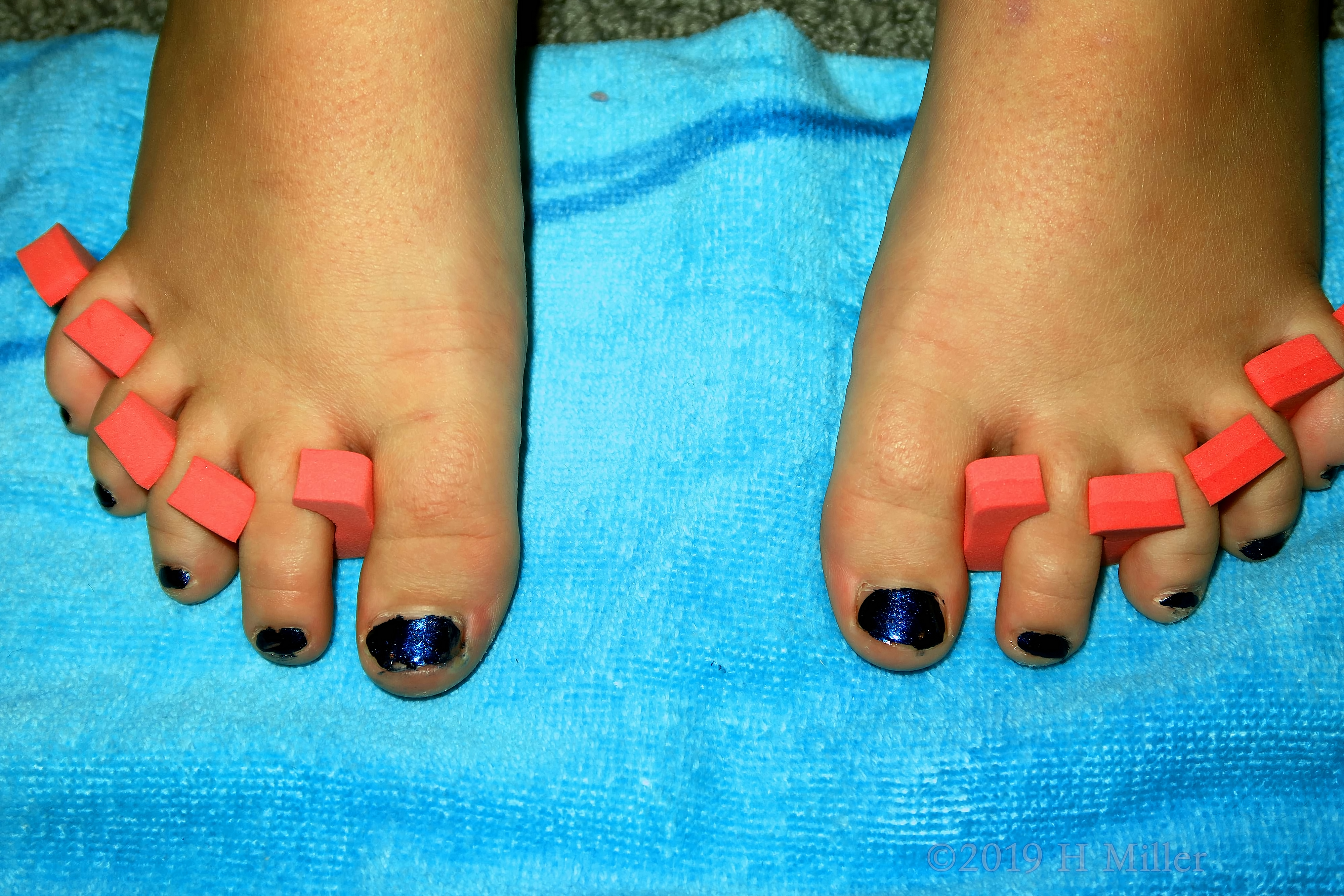 Kids Pedicure Close Up With Protectors. 