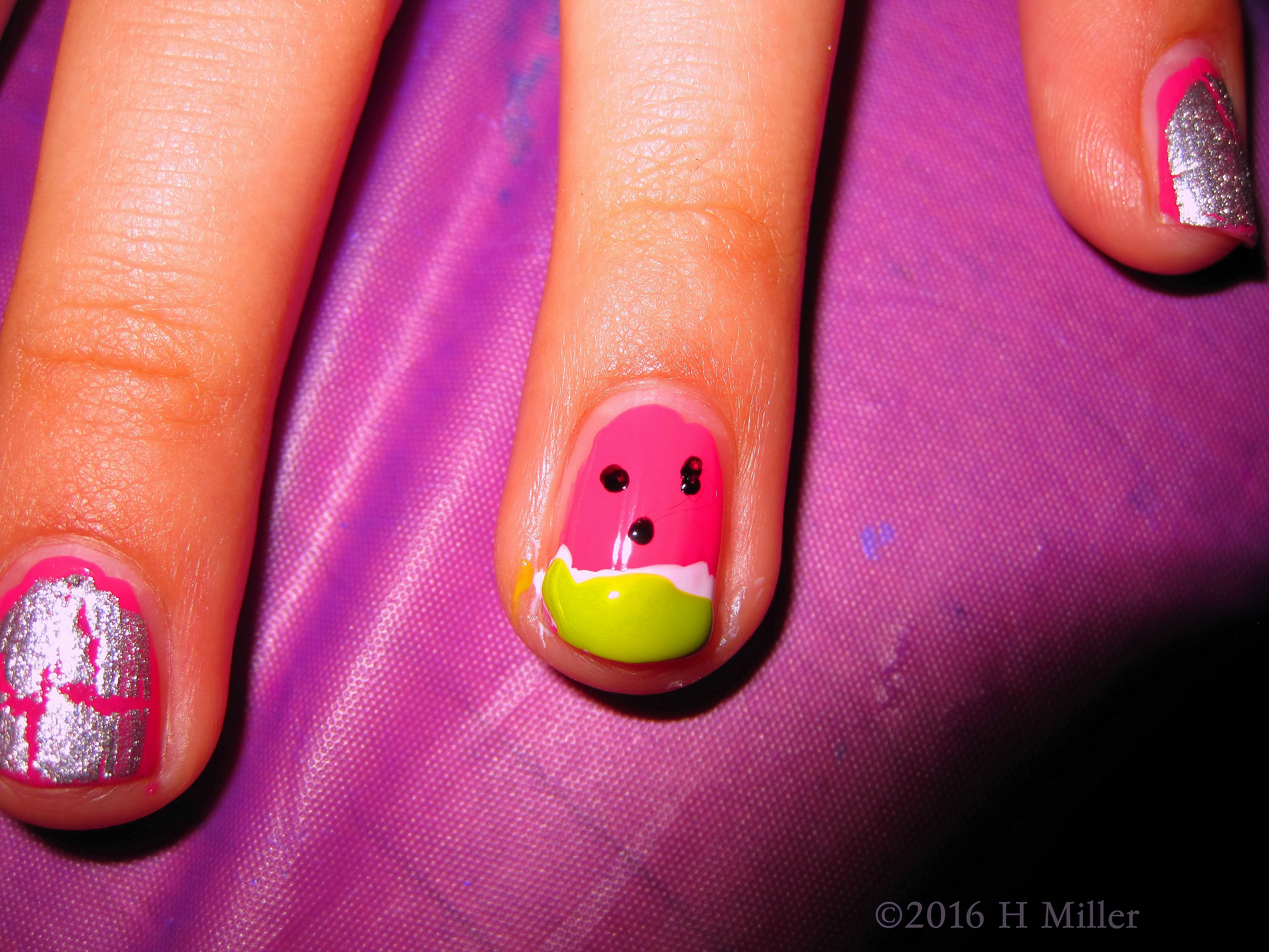 She Has A Watermelon On Her Nail! She Has A Watermelon On Her Nail!