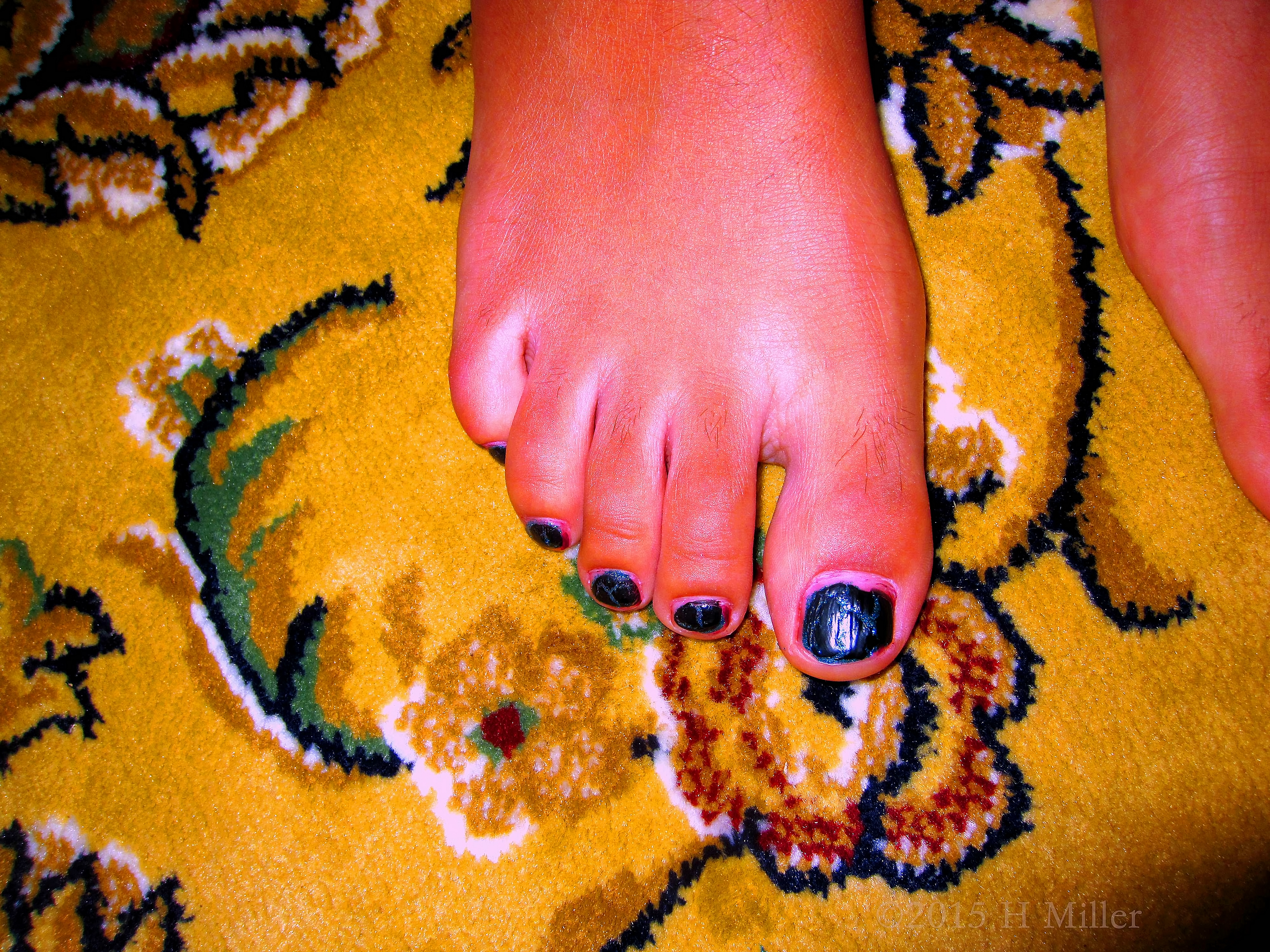 Look Her Pedicure Matches The Carpet Design Color And Contrasts Well With The Yellow! Look Her Pedicure Matches The Carpet Design Color And Contrasts Well With The Yellow!