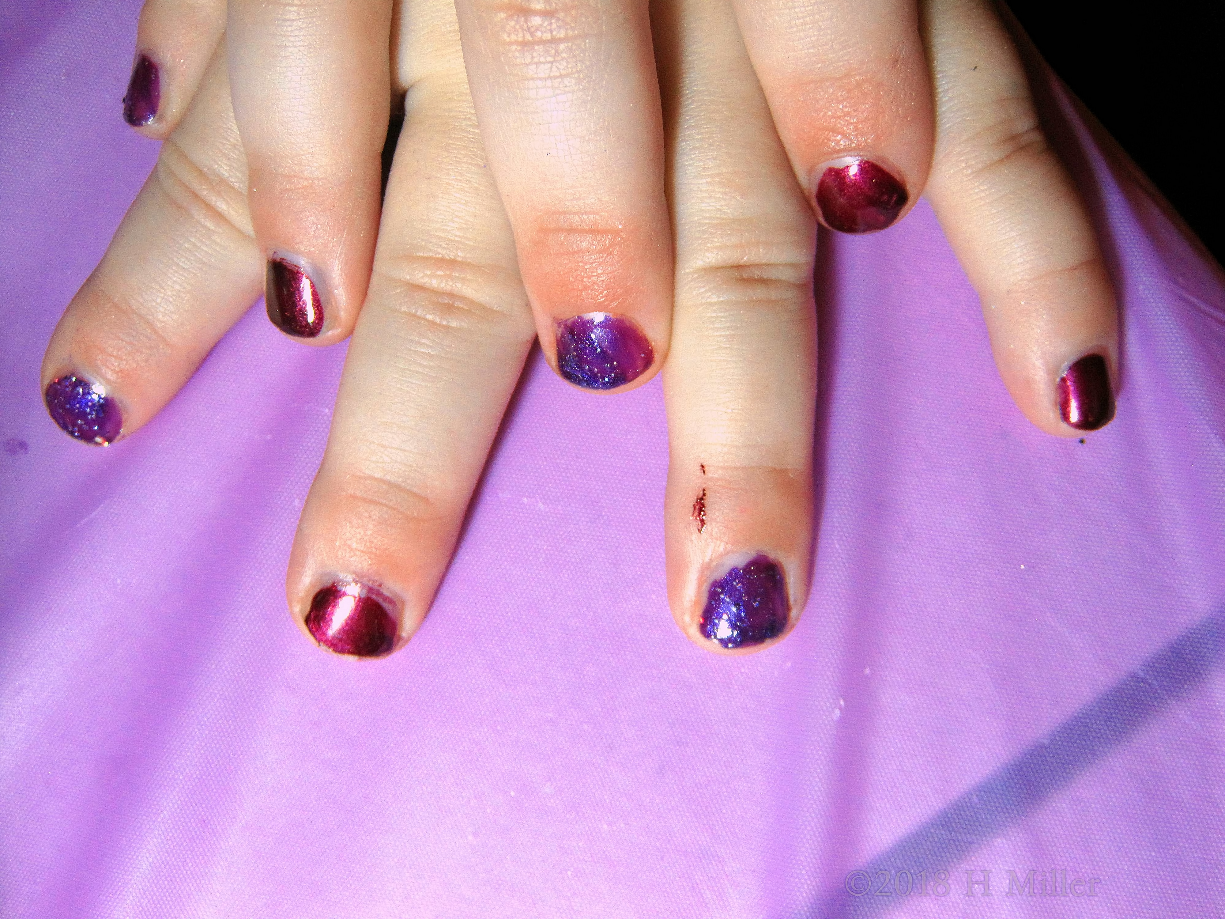 Purple Glittler And Red Polish On Party Guest Kids Mani!