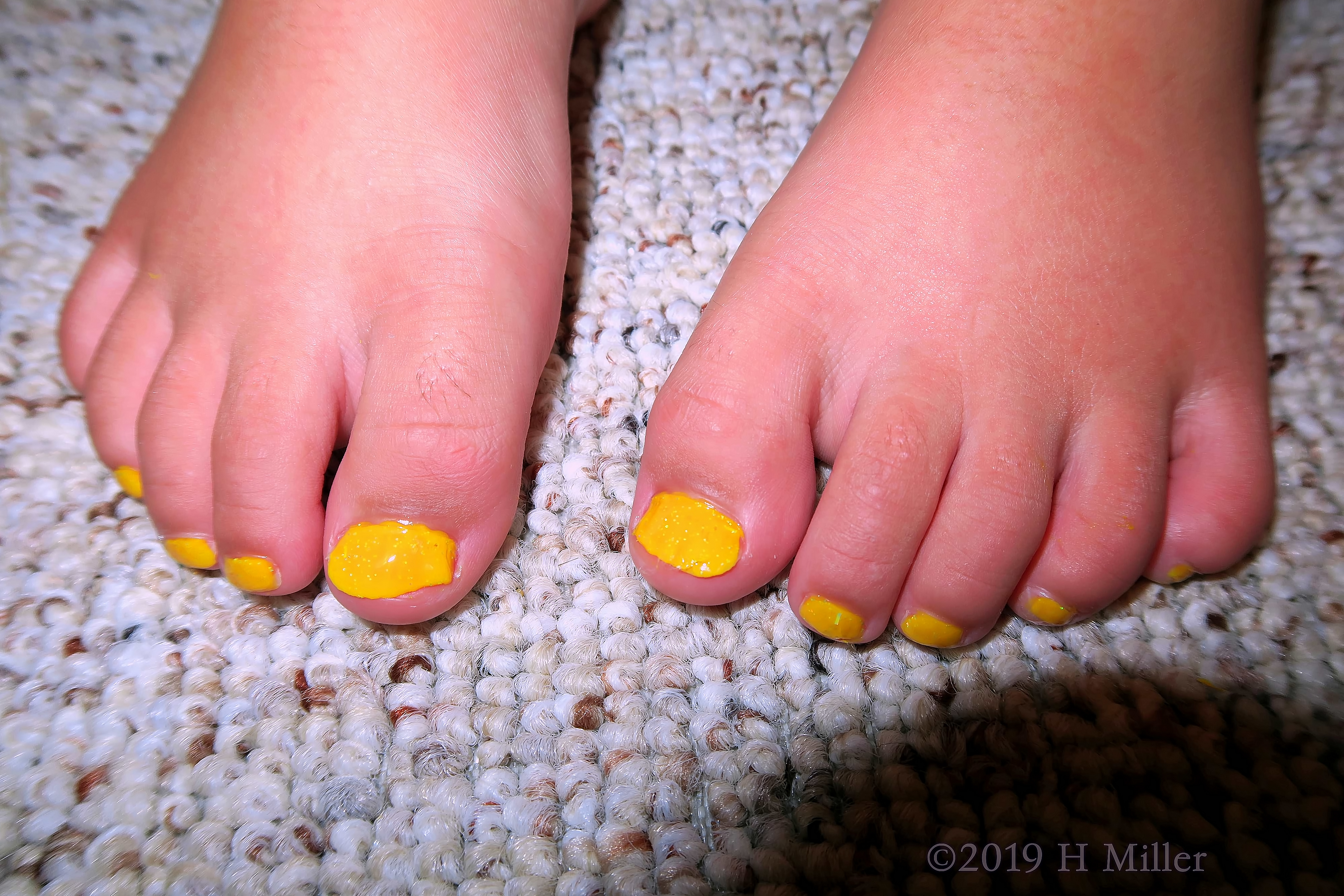 Awesomeness! Lovely Yellow Pedicure For Girls 