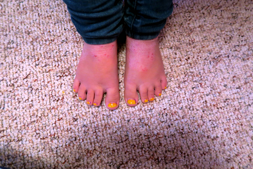 I Got Sunshine For My Pretty Kids Pedicure!! LOL!