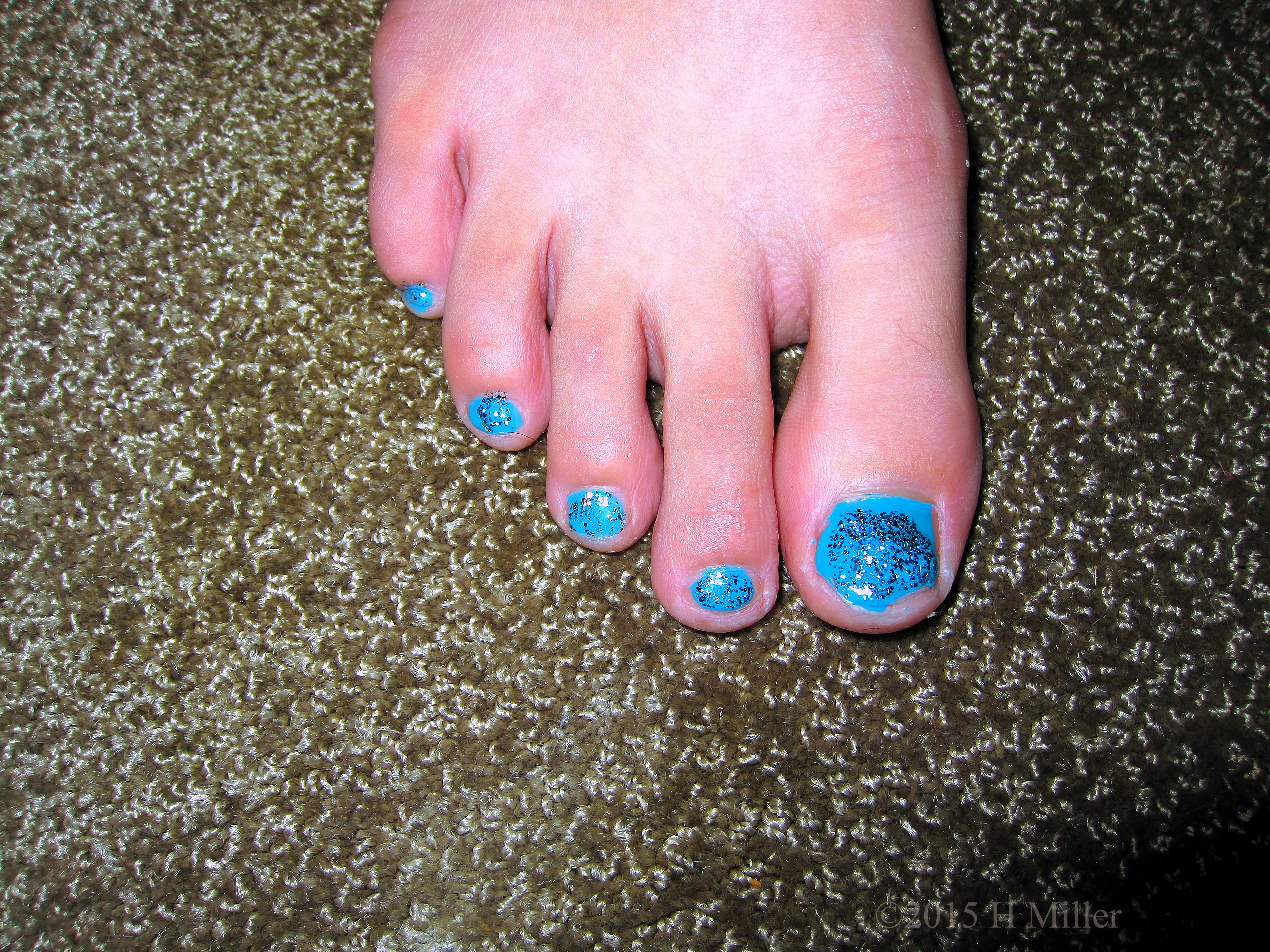 Robin's Egg Blue Girls Pedi With Silver Sparkly Glitter. Robin's Egg Blue Girls Pedi With Silver Sparkly Glitter.
