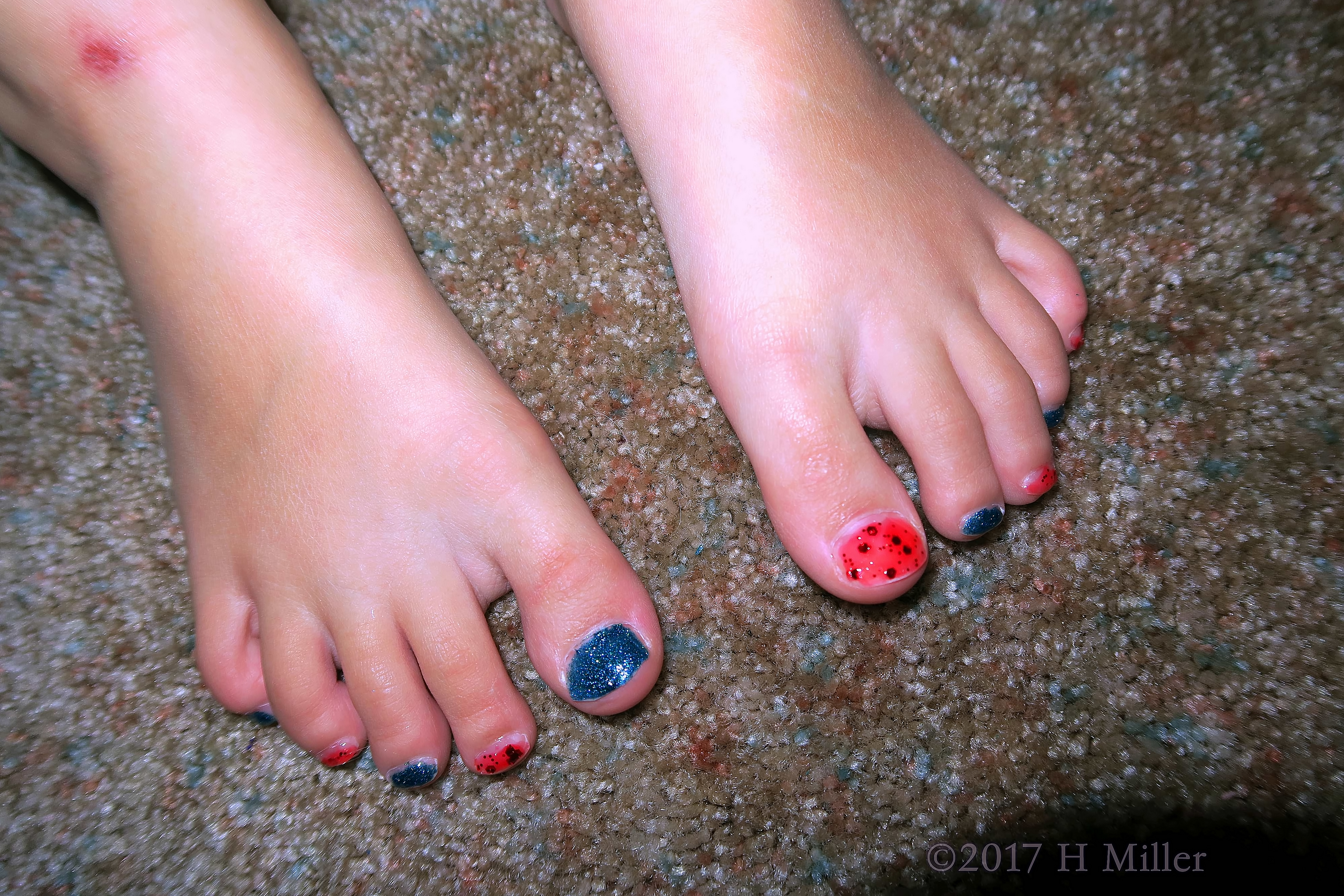 Shiny Blue With Orange Kids Pedi Decorated With Sparkles And Dots 