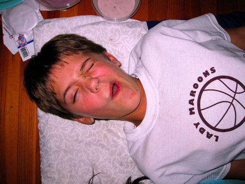 Ready For The Before Facial Pic! Ready For The Before Facial Pic!