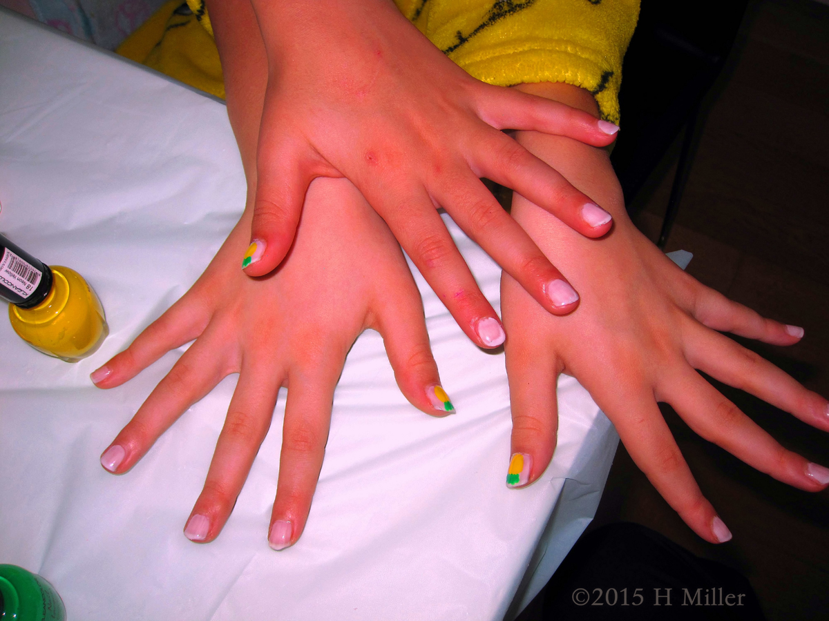 Mani With Yellow And Pineapple Designs. Why Are There THREE Hands!lol 