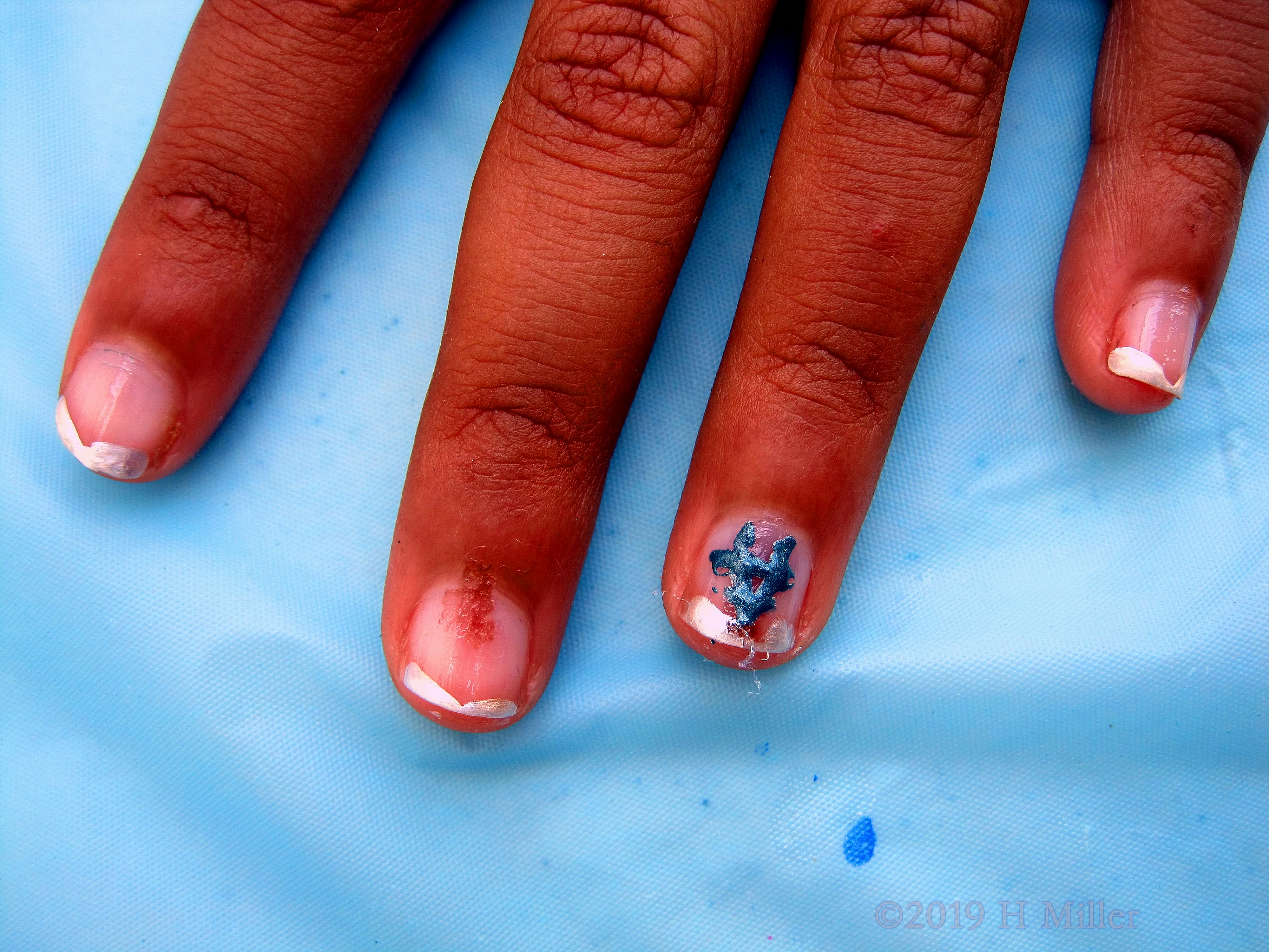 White Tipped French Manicure With Blue A Accent Nail Art. 4 White Tipped French Manicure With Blue A Accent Nail Art. 4