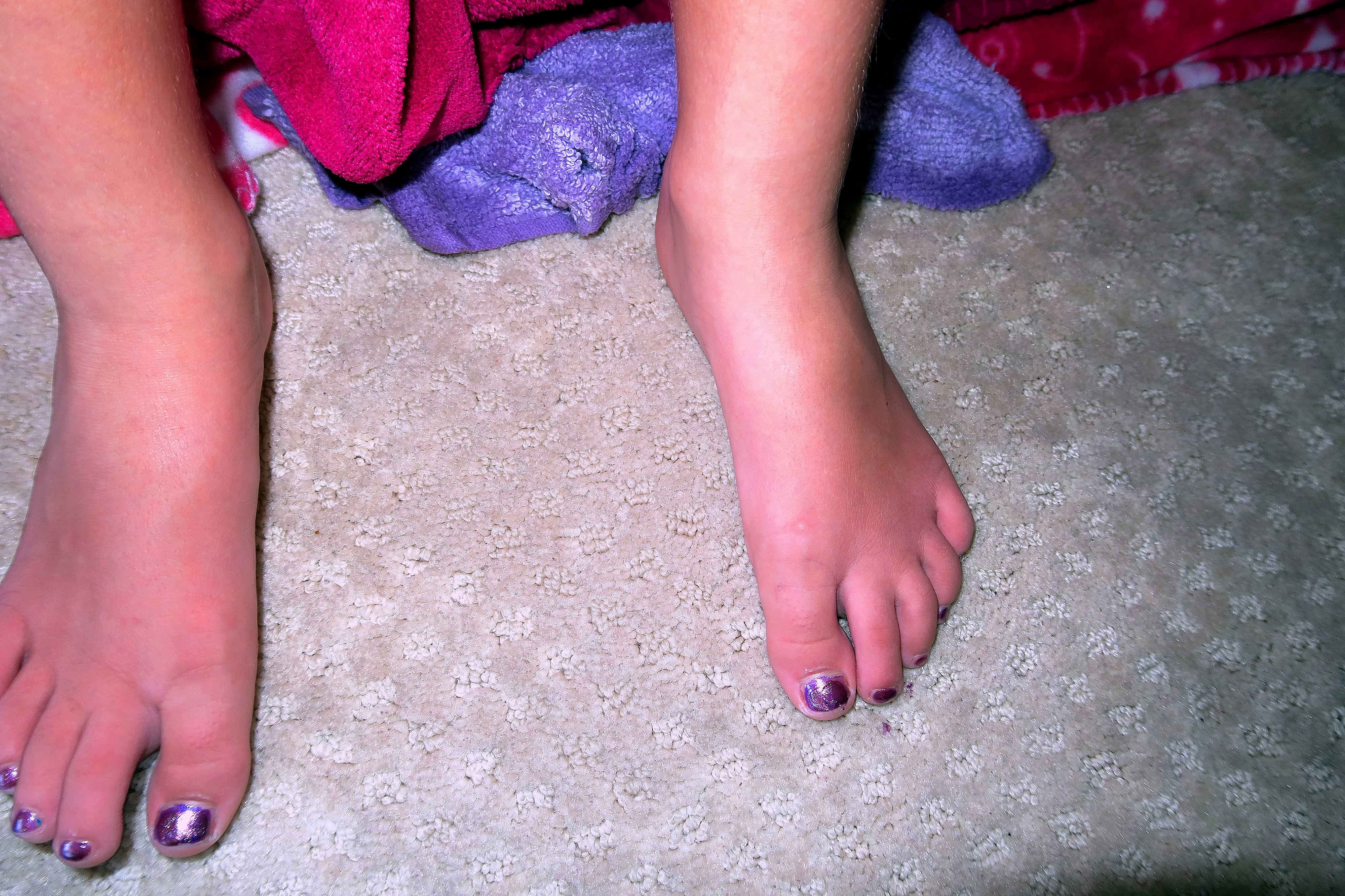 PURPLE PEDI!!! PURPLE PEDI!!!