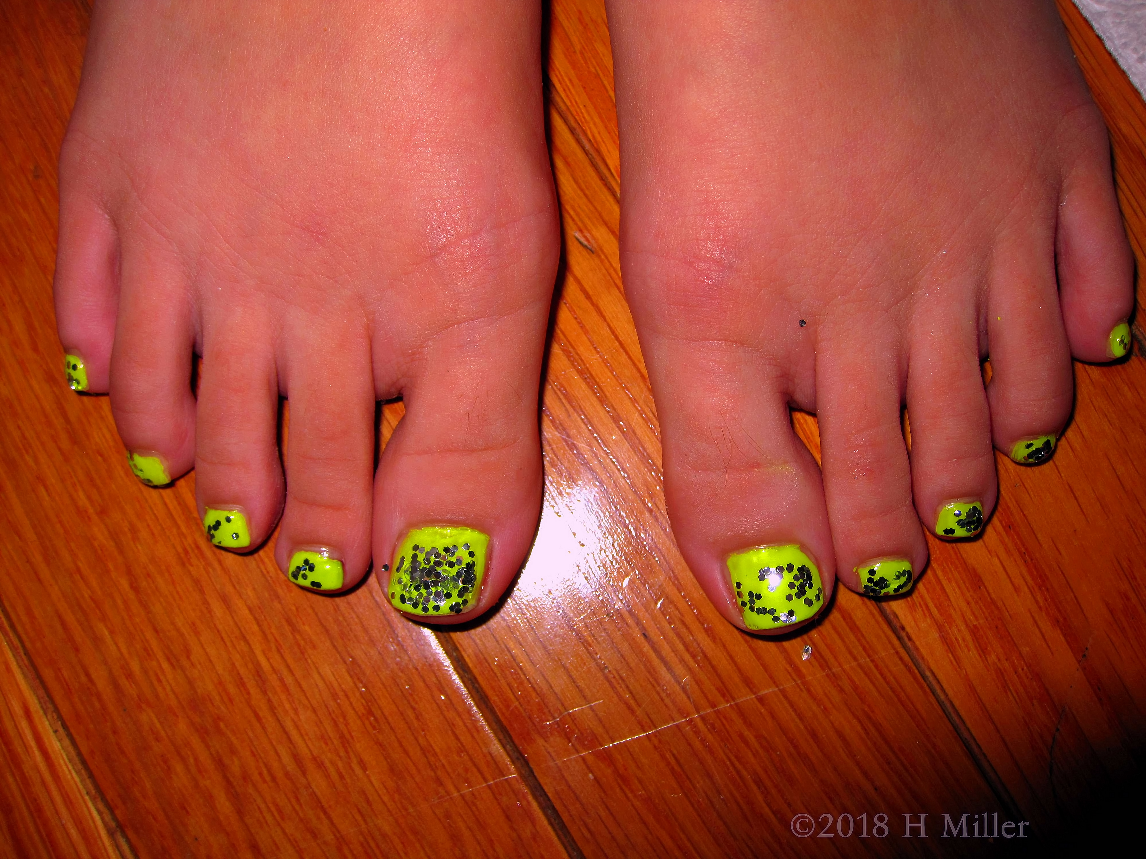 Yellow Base With Silver Sparkles For This Mini Pedi Yellow Base With Silver Sparkles For This Mini Pedi