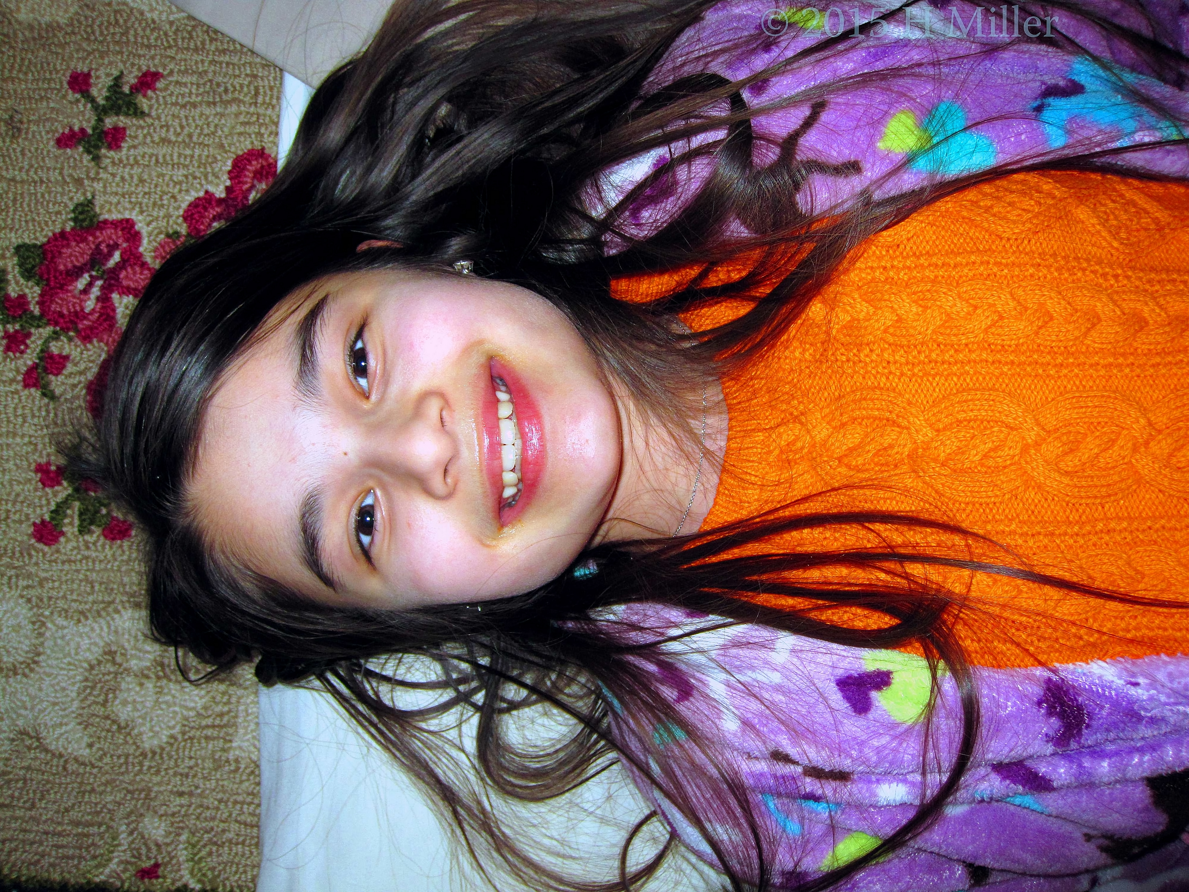 Pre Facial Pic. Pre Facial Pic.