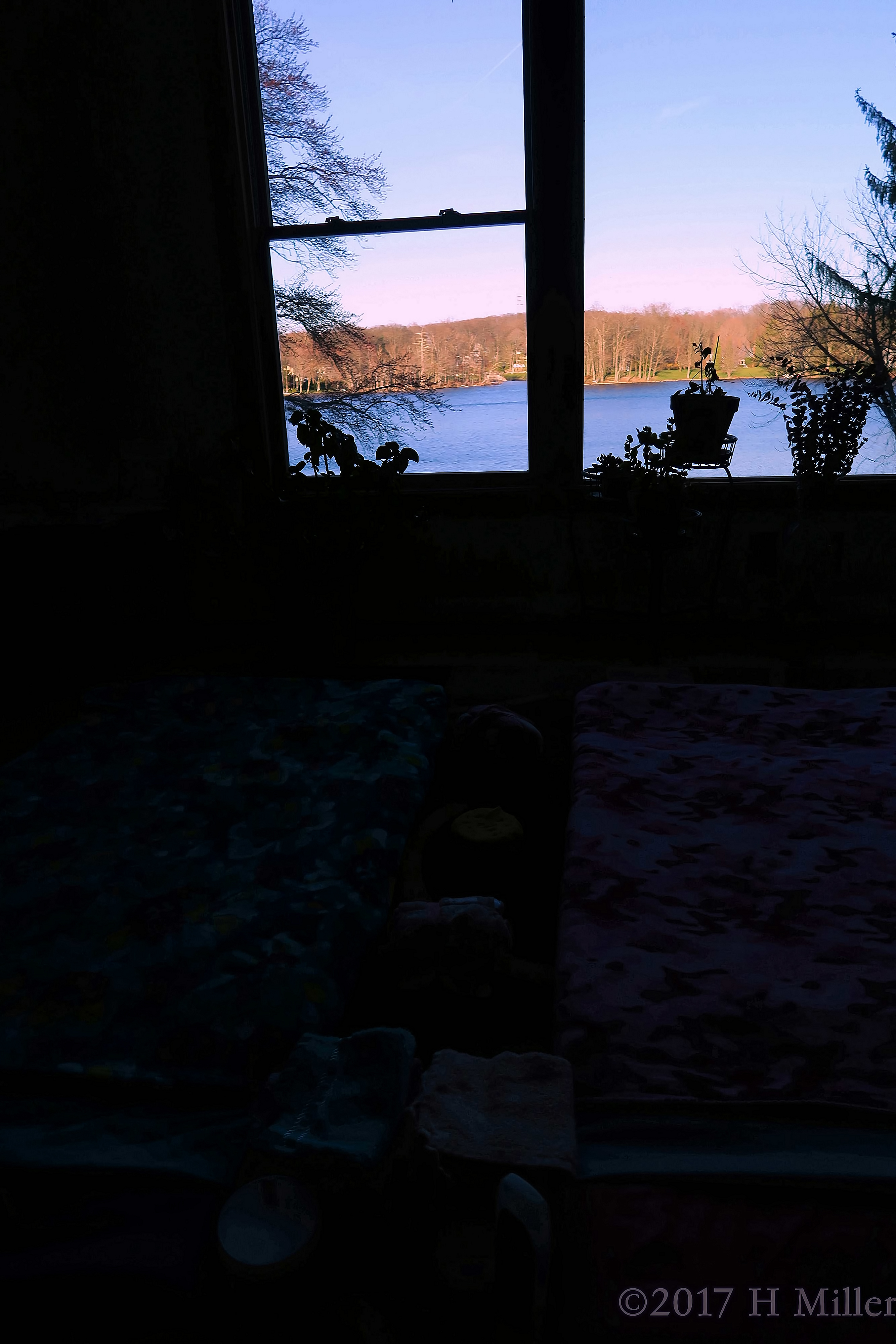 Spa Facial Setup With Relaxing View Of The Lake Spa Facial Setup With Relaxing View Of The Lake