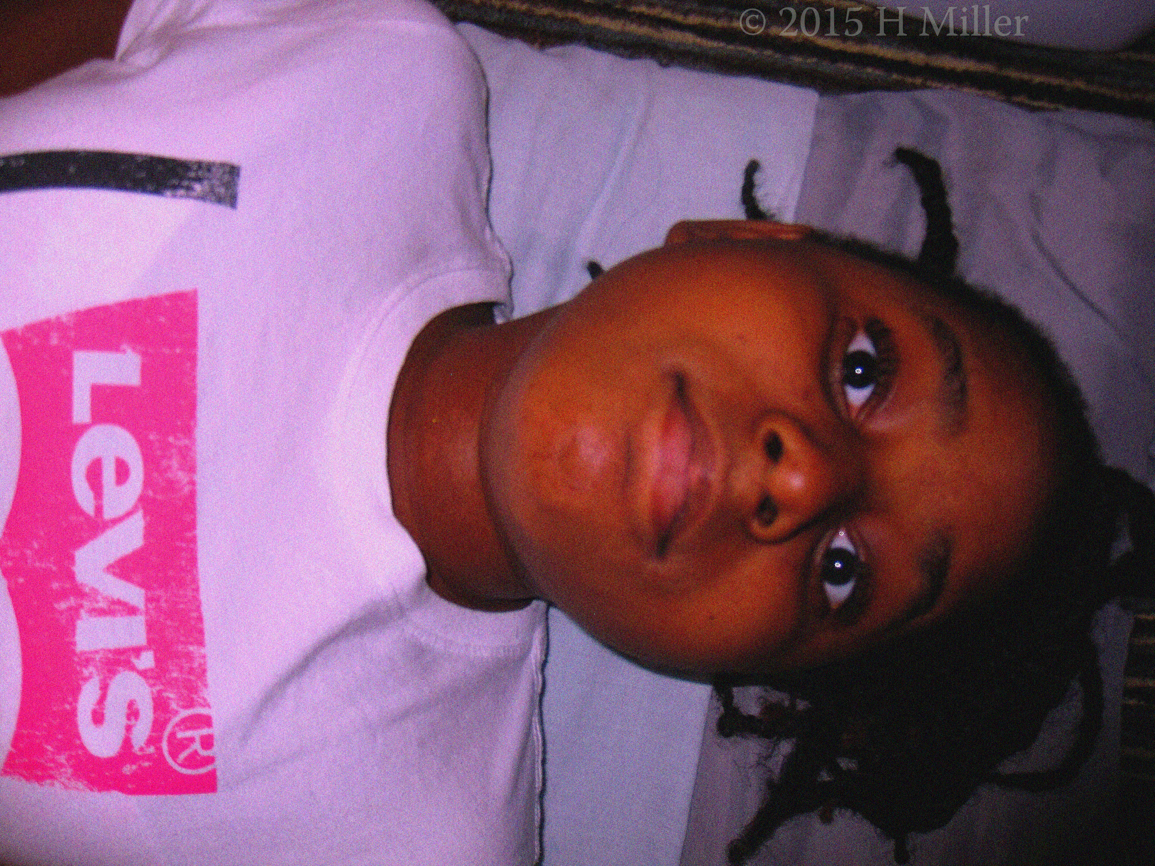 Before The Facial. Before The Facial.